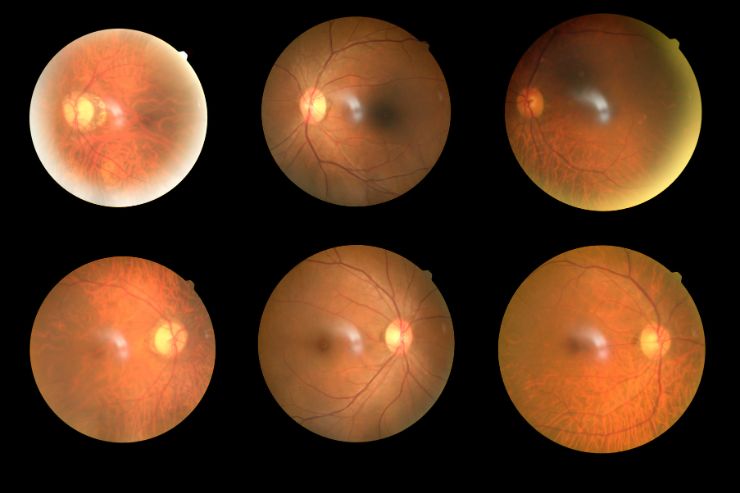 Retina And Lens Lab