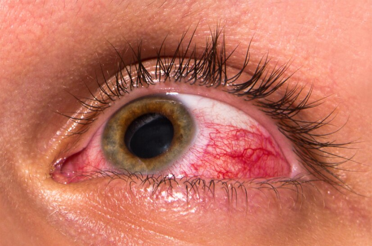 Retina And Lens Lab